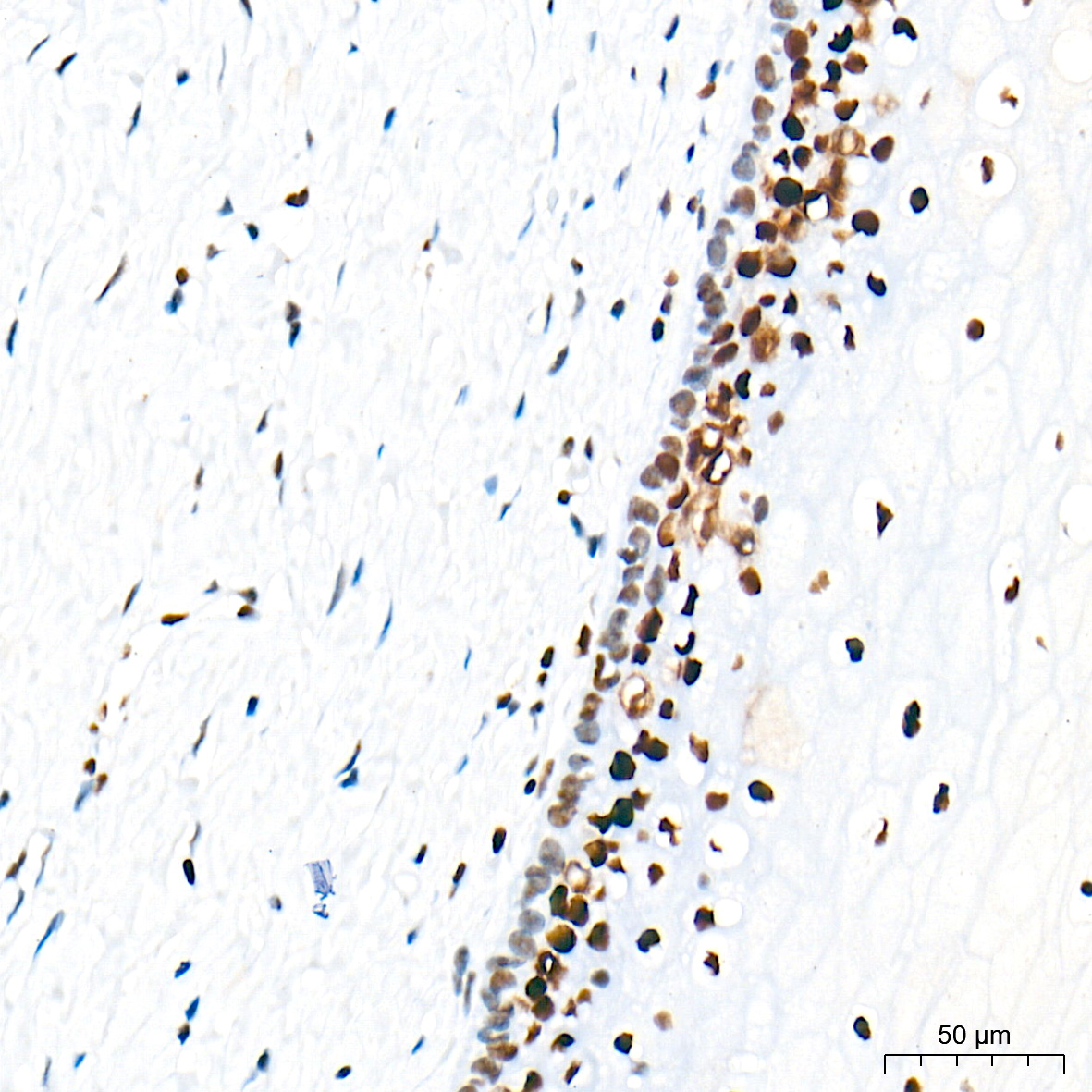 Immunohistochemistry analysis of paraffin-embedded Human cervix tissue using RB Rabbit mAb at a dilution of 1:5000 (40x lens). High pressure antigen retrieval performed with 0.01M Tris-EDTA Buffer (pH 9.0) prior to IHC staining.