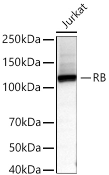 Western blot analysis of lysates from Jurkat cells using RB Rabbit mAb at 1:80000 dilution incubated at room temperature for 1.5 hours.|Secondary antibody: HRP-conjugated Goat anti-Rabbit IgG (H+L) at 1:10000 dilution.|Lysates/proteins: 25 μg per lane.|Blocking buffer: 3% nonfat dry milk in TBST.|Detection: ECL Basic Kit.|Exposure time: 45s.