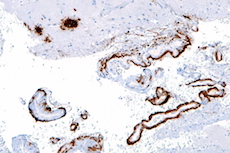 Amyloid-Beta Antibody