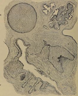 Breast Cancer Imaging