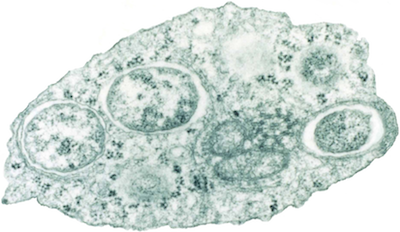 Combat Zika Virus with Bacteria Combat Zika Virus with Bacteria