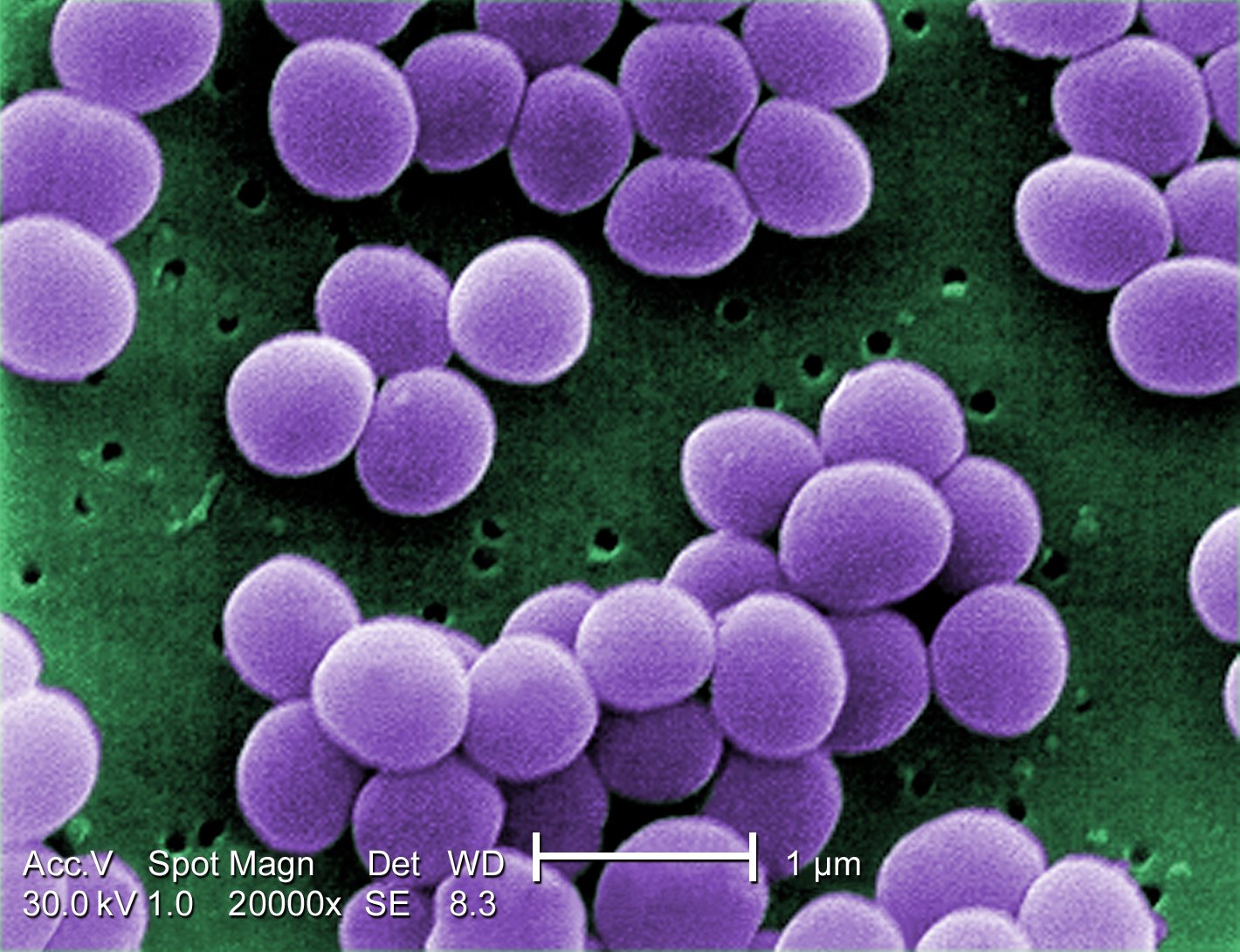 Staphylococcus Aureus ProSci