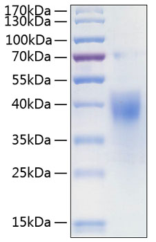 Recombinant Human IFN-gamma R1/CD119 Protein was determined by SDS-PAGE under reducing conditions with Coomassie Blue.