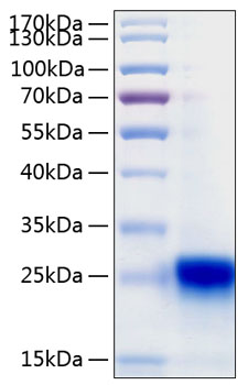 Recombinant Human IFN-lambda 3/IL-28B Protein was determined by SDS-PAGE under reducing conditions with Coomassie Blue.
