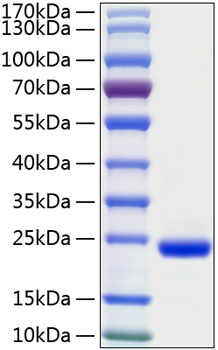 Recombinant Human IFN-lambda 2/IL-28A Protein was determined by SDS-PAGE under reducing conditions with Coomassie Blue.