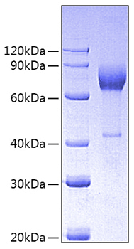 Recombinant Pig CSF-1/M-CSF Protein was determined by SDS-PAGE under reducing (R) and non-reducing (NR) conditions.