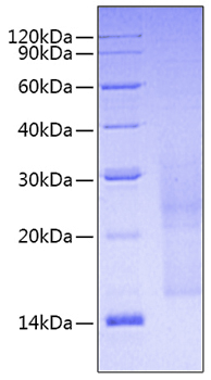 Recombinant Human LGR5 / GPR49 protein was determined by SDS-PAGE under reducing conditions with Coomassie Blue.
