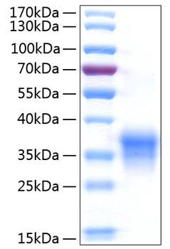 Recombinant Human IFN-lambda 1/IL-29 Protein was determined by SDS-PAGE under reducing conditions with Coomassie Blue.