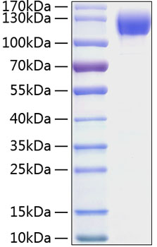 Recombinant Mouse ICAM-1/CD54 Protein was determined by SDS-PAGE under reducing conditions with Coomassie Blue.