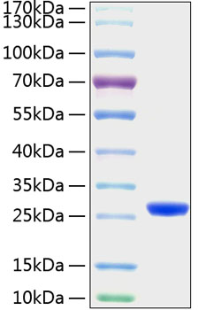 Recombinant Mouse Lipocalin-2/NGAL/LCN2 Protein was determined by SDS-PAGE under reducing conditions with Coomassie Blue.