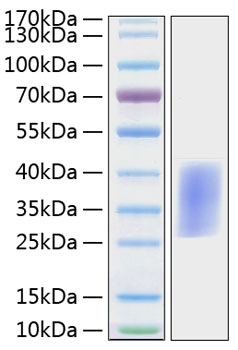 Recombinant Mouse PD-1/PDCD1/CD279 Protein was determined by SDS-PAGE under reducing conditions with Coomassie Blue.