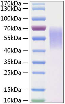Recombinant Human LYPD3 Protein was determined by SDS-PAGE under reducing conditions with Coomassie Blue.