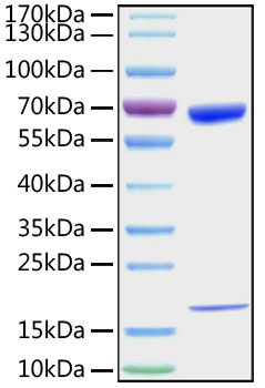 Recombinant Mouse PCSK9 Protein was determined by SDS-PAGE under reducing conditions with Coomassie Blue.