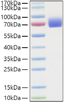Recombinant Human IFNAR2 Protein was determined by SDS-PAGE under reducing conditions with Coomassie Blue.
