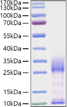 Recombinant Mouse IL-3 Protein was determined by SDS-PAGE under reducing conditions with Coomassie Blue.