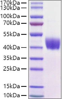 Recombinant Mouse Mesothelin/MSLN Protein was determined by SDS-PAGE under reducing conditions with Coomassie Blue.