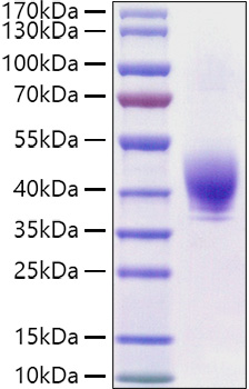 Recombinant Rat TROP-2/TACSTD2 Protein was determined by SDS-PAGE under reducing conditions with Coomassie Blue.