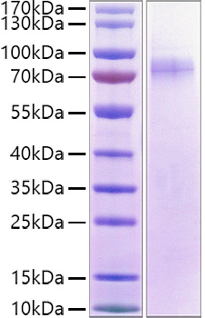 Recombinant Human LILRA1/LIR-6/CD85i Protein was determined by SDS-PAGE under reducing conditions with Coomassie Blue.