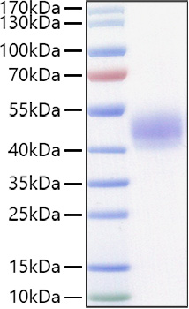 Recombinant Mouse Lung surfactant protein D/SFTPD Protein was determined by SDS-PAGE under reducing conditions with Coomassie Blue.
