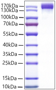 Recombinant Mouse VEGFR-2/KDR/CD309 Protein was determined by SDS-PAGE under reducing conditions with Coomassie Blue.