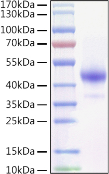 Recombinant Mouse TNFRSF13C/BAFFR/CD268 Protein was determined by SDS-PAGE under reducing conditions with Coomassie Blue.