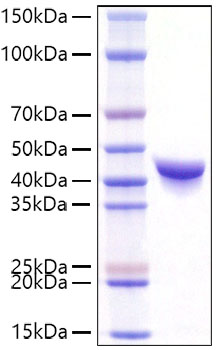 Recombinant Mouse YKL-40/CHI3L1 Protein was determined by SDS-PAGE under reducing conditions with Coomassie Blue.