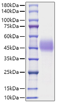 Recombinant Mouse TFPI Protein was determined by SDS-PAGE under reducing conditions with Coomassie Blue.