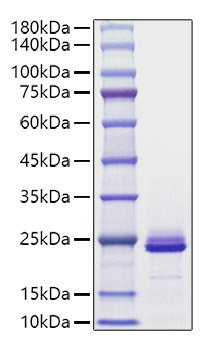 Recombinant Mouse FGF-21 Protein was determined by SDS-PAGE under reducing conditions with Coomassie Blue.