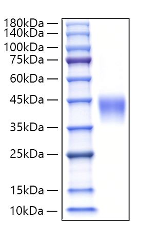 Recombinant Human Lutropin beta chain/LHB Protein was determined by SDS-PAGE under reducing conditions with Coomassie Blue.