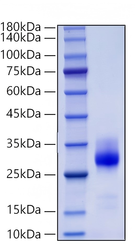 Recombinant Mouse Nkrp1c/NK1.1/CD161c Protein was determined by SDS-PAGE under reducing conditions with Coomassie Blue.