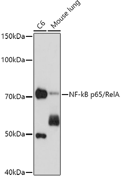 Western blot analysis of various lysates using NF-kB p65/RelA Mouse mAb at 1:1000 dilution.|Secondary antibody: HRP-conjugated Goat anti-Mouse IgG (H+L) at 1:10000 dilution.|Lysates/proteins: 25μg per lane.|Blocking buffer: 3% nonfat dry milk in TBST.|Detection: ECL Basic Kit.|Exposure time: 90s.
