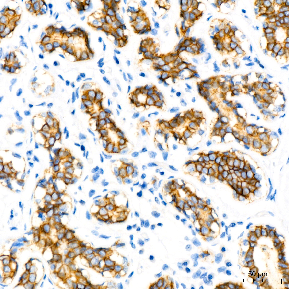 Immunohistochemistry analysis of paraffin-embedded Human breast tissue using E-Cadherin mouse mAb at a dilution of 1:200 (40x lens). Microwave antigen retrieval performed with 0.01M Tris-EDTA Buffer (pH 9.0) prior to IHC staining.