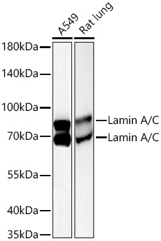 Western blot analysis of various lysates using [KO Validated] Lamin A/C Mouse mAb at 1:10000 dilution incubated overnight at 4℃.|Secondary antibody: HRP Goat Anti-Mouse IgG (H+L) antibody at 1:10000 dilution.|Lysates/proteins: 25 μg per lane.|Blocking buffer: 3% nonfat dry milk in TBST.|Detection: ECL Basic Kit.|Exposure time: 45s.