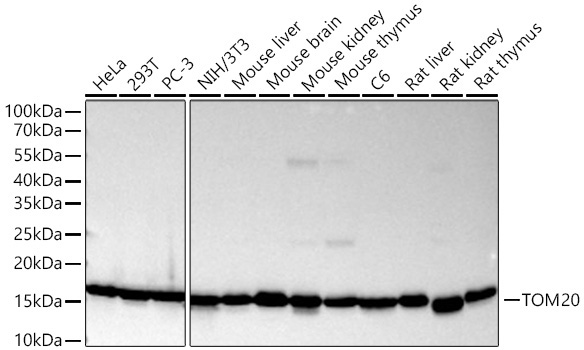 Western blot analysis of various lysates using TOM20 Mouse mAb at 1:6000 dilution incubated overnight at 4℃.|Secondary antibody: HRP-conjugated Goat anti-Mouse IgG (H+L) at 1:10000 dilution.|Lysates/proteins: 25 μg per lane.|Blocking buffer: 3% nonfat dry milk in TBST.|Detection: ECL Basic Kit.|Exposure time: 45 s.