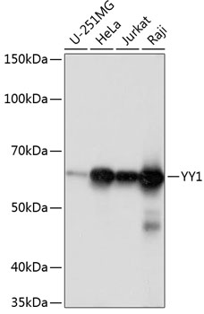 Western blot analysis of various lysates using YY1 Rabbit mAb at 1:1000 dilution.|Secondary antibody: HRP-conjugated Goat anti-Rabbit IgG (H+L) at 1:10000 dilution.|Lysates/proteins: 25μg per lane.|Blocking buffer: 3% nonfat dry milk in TBST.|Detection: ECL Basic Kit.|Exposure time: 1s.