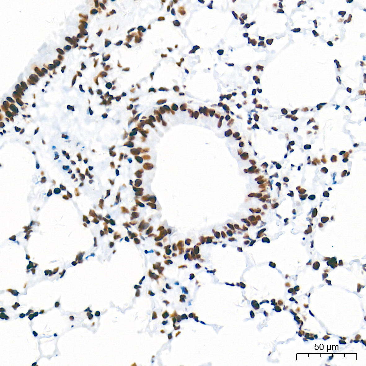 Immunohistochemistry analysis of paraffin-embedded Mouse lung tissue using HDAC1 Rabbit mAb at a dilution of 1:2000 (40x lens). High pressure antigen retrieval performed with 0.01M Tris-EDTA Buffer (pH 9.0) prior to IHC staining.