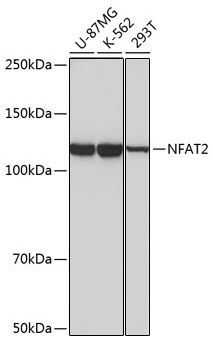 Western blot analysis of various lysates using NFAT2 Rabbit mAb at 1:1000 dilution.|Secondary antibody: HRP-conjugated Goat anti-Rabbit IgG (H+L) at 1:10000 dilution.|Lysates/proteins: 25μg per lane.|Blocking buffer: 3% nonfat dry milk in TBST.|Detection: ECL Basic Kit.|Exposure time: 10s.
