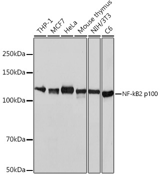 Western blot analysis of various lysates using NF-κB2 Rabbit mAb at 1:1000 dilution.|Secondary antibody: HRP-conjugated Goat anti-Rabbit IgG (H+L) at 1:10000 dilution.|Lysates/proteins: 25μg per lane.|Blocking buffer: 3% nonfat dry milk in TBST.|Detection: ECL Basic Kit.|Exposure time: 3s.