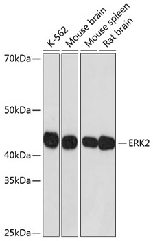 Western blot analysis of extracts of various cell lines using ERK2 Rabbit mAb at 1:1000 dilution incubated overnight at 4℃.|Secondary antibody: HRP Goat Anti-Rabbit IgG (H+L) at 1:10000 dilution.|Lysates/proteins: 25 μg  per lane.|Blocking buffer: 3% nonfat dry milk in TBST.|Detection: ECL Basic Kit.|Exposure time: 1 s.