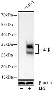 Western blot analysis of lysates from THP-1 cells using IL1β Rabbit mAb at 1:1000 dilution incubated overnight at 4℃. THP-1 cells were treated with LPS (0.5 μg/mL) for 2 hours after serum starvation overnight.|Secondary antibody: HRP-conjugated Goat anti-Rabbit IgG (H+L) at 1:10000 dilution.|Lysates/proteins: 30 μg per lane.| Blocking buffer: 3% nonfat dry milk in TBST.| Detection: ECL Basic Kit.| Exposure time: 5 s.