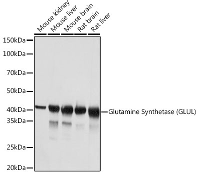 Western blot analysis of various lysates using Glutamine Synthetase (GLUL) Rabbit mAb at 1:1000 dilution.|Secondary antibody: HRP-conjugated Goat anti-Rabbit IgG (H+L) at 1:10000 dilution.|Lysates/proteins: 25μg per lane.|Blocking buffer: 3% nonfat dry milk in TBST.|Detection: ECL Basic Kit.|Exposure time: 1s.