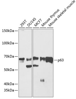 Western blot analysis of various lysates using p63 Rabbit mAb at 1:1000 dilution.|Secondary antibody: HRP-conjugated Goat anti-Rabbit IgG (H+L) at 1:10000 dilution.|Lysates/proteins: 25μg per lane.|Blocking buffer: 3% nonfat dry milk in TBST.|Detection: ECL Basic Kit.|Exposure time: 3min.