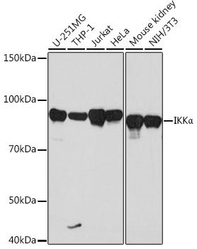 Western blot analysis of various lysates using IKKα Rabbit mAb at 1:1000 dilution.|Secondary antibody: HRP-conjugated Goat anti-Rabbit IgG (H+L) at 1:10000 dilution.|Lysates/proteins: 25μg per lane.|Blocking buffer: 3% nonfat dry milk in TBST.|Detection: ECL Basic Kit.|Exposure time: 90s.