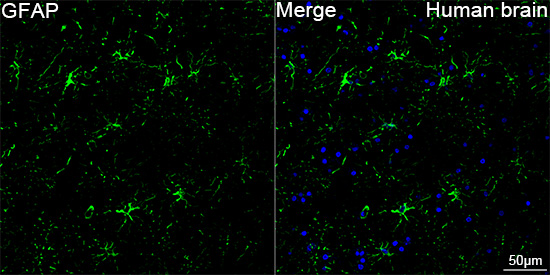 Confocal imaging of paraffin-embedded Human brain tissue using PSFlo 488 Conjugated GFAP Rabbit mAb. DAPI was used for nuclear staining (Blue). Microwave antigen retrieval performed with 0.01M Citrate Buffer(pH 6.0) prior to IF staining. Objective: 40x.