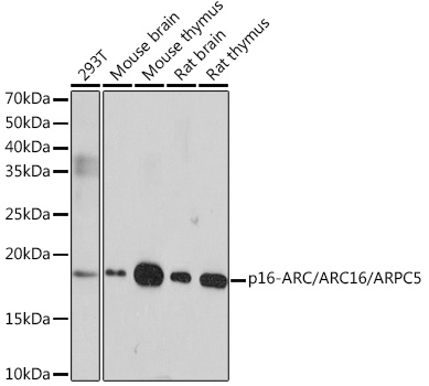 Western blot analysis of various lysates using p16-ARC/ARC16/ARPC5 Rabbit mAb at 1:1000 dilution.|Secondary antibody: HRP-conjugated Goat anti-Rabbit IgG (H+L) at 1:10000 dilution.|Lysates/proteins: 25μg per lane.|Blocking buffer: 3% nonfat dry milk in TBST.|Detection: ECL Enhanced Kit.|Exposure time: 3min.