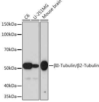 Western blot analysis of various lysates using βII-Tubulin/β2-Tubulin Rabbit mAb at 1:1000 dilution.|Secondary antibody: HRP-conjugated Goat anti-Rabbit IgG (H+L) at 1:10000 dilution.|Lysates/proteins: 25μg per lane.|Blocking buffer: 3% nonfat dry milk in TBST.|Detection: ECL Basic Kit.|Exposure time: 60s.