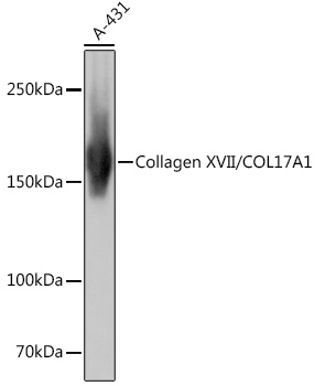 Western blot analysis of lysates from A-431 cells, using Collagen XVII/COL17A1 Rabbit mAb at 1:1000 dilution.|Secondary antibody: HRP-conjugated Goat anti-Rabbit IgG (H+L) at 1:10000 dilution.|Lysates/proteins: 25μg per lane.|Blocking buffer: 3% nonfat dry milk in TBST.|Detection: ECL Basic Kit.|Exposure time: 1s.