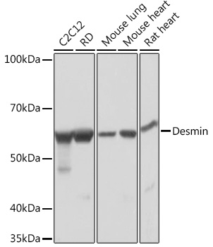 Western blot analysis of various lysates using Desmin Rabbit mAb at 1:1000 dilution.|Secondary antibody: HRP-conjugated Goat anti-Rabbit IgG (H+L) at 1:10000 dilution.|Lysates/proteins: 25μg per lane.|Blocking buffer: 3% nonfat dry milk in TBST.|Detection: ECL Basic Kit.|Exposure time: 1s.