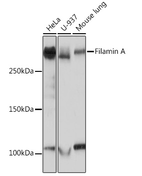 Western blot analysis of various lysates using Filamin A Rabbit mAb at 1:1000 dilution.|Secondary antibody: HRP-conjugated Goat anti-Rabbit IgG (H+L) at 1:10000 dilution.|Lysates/proteins: 25μg per lane.|Blocking buffer: 3% nonfat dry milk in TBST.|Detection: ECL Basic Kit.|Exposure time: 1s.