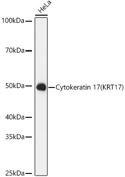 Western blot analysis of lysates from HeLa cells, using Cytokeratin 17 (KRT17) Rabbit mAb at 1:1000 dilution.|Secondary antibody: HRP-conjugated Goat anti-Rabbit IgG (H+L) at 1:10000 dilution.|Lysates/proteins: 25μg per lane.|Blocking buffer: 3% nonfat dry milk in TBST.|Detection: ECL Basic Kit.|Exposure time: 90s.